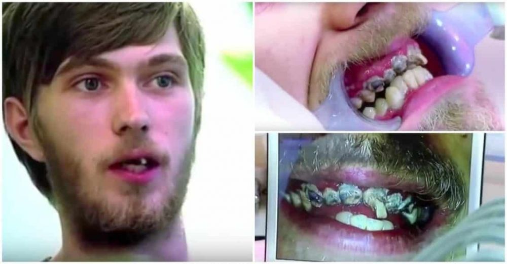 O que aconteceu com o homem que ficou 20 anos sem escovar os dentes?